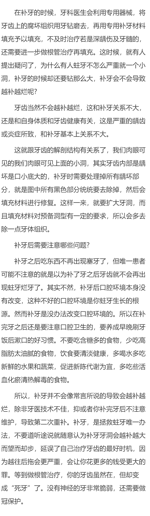 补牙会不会越补越烂？