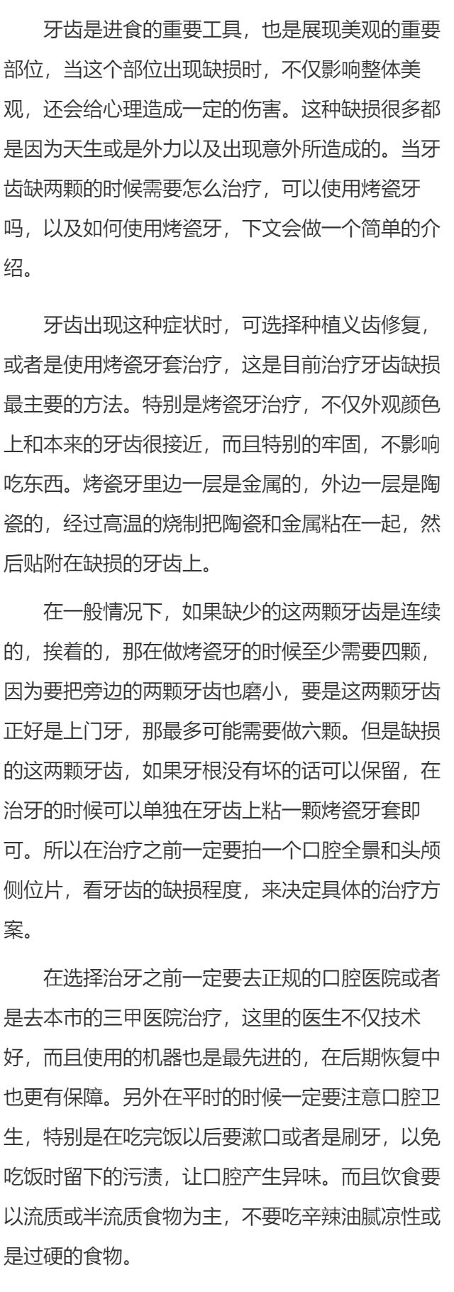 缺2颗牙可以烤瓷牙吗 缺2颗牙齿如何做烤瓷牙