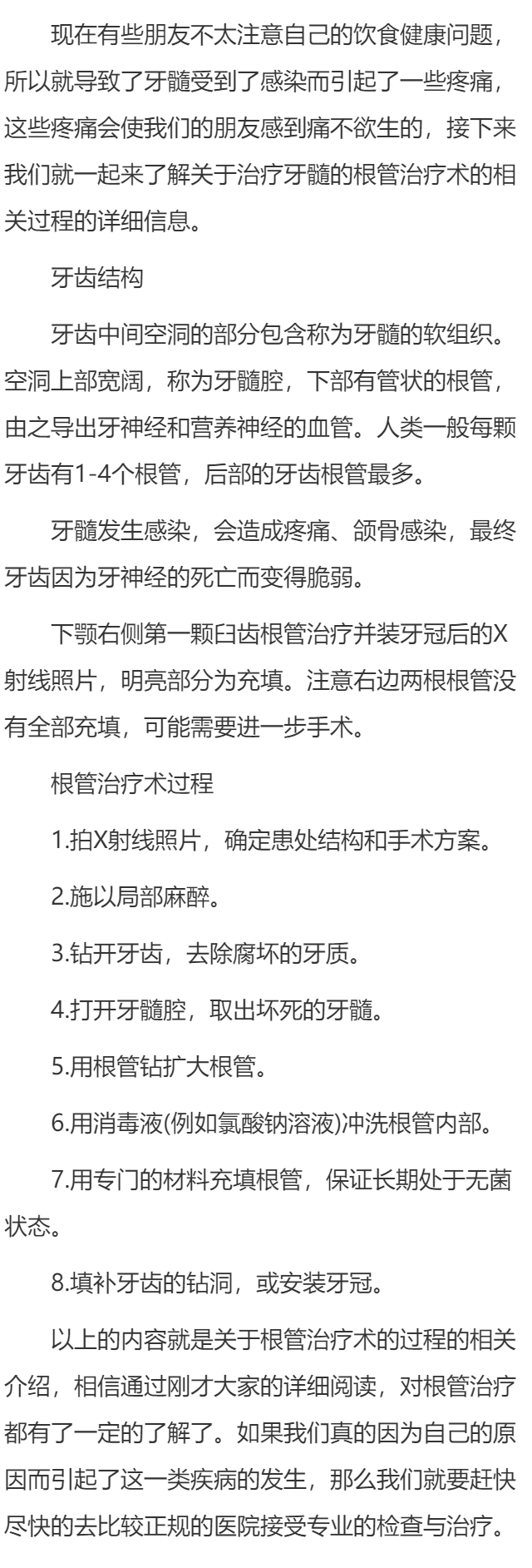 根管治疗的相关步骤
