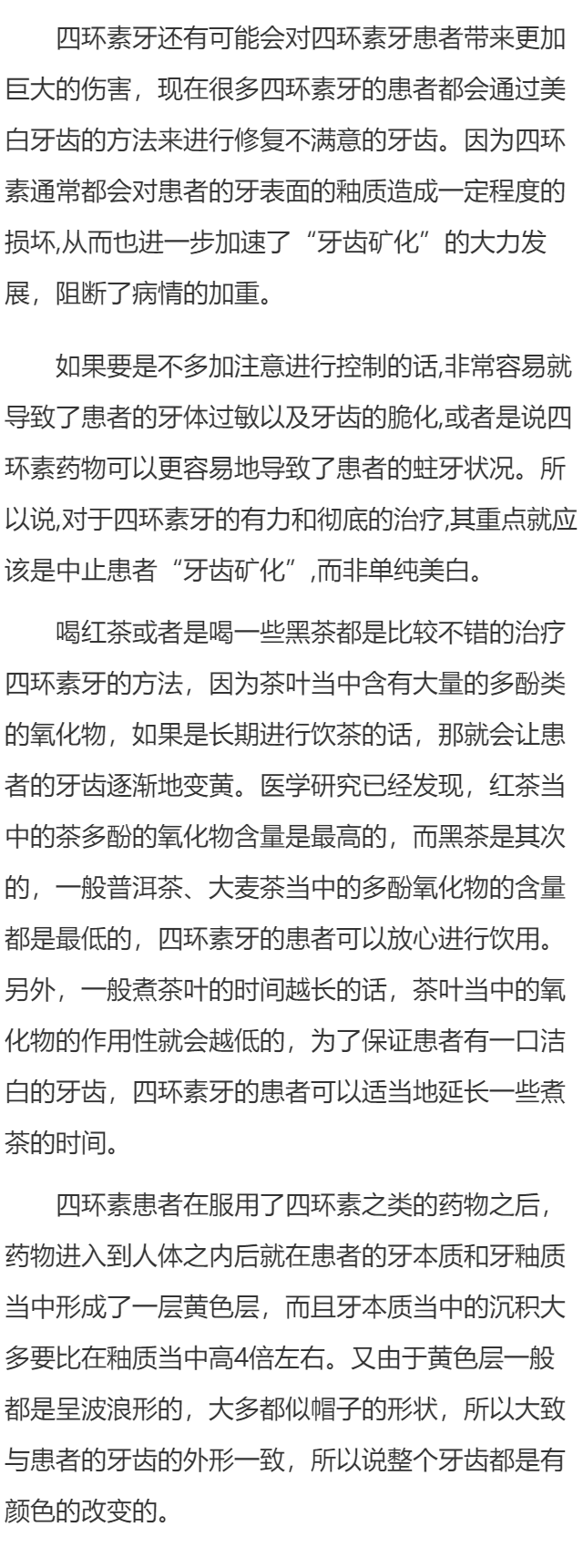 如何美白重度四环素牙