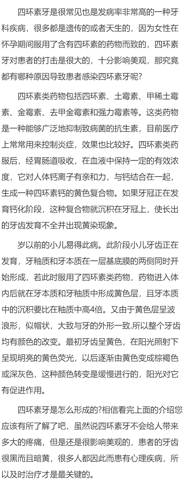四环素牙是怎么形成的