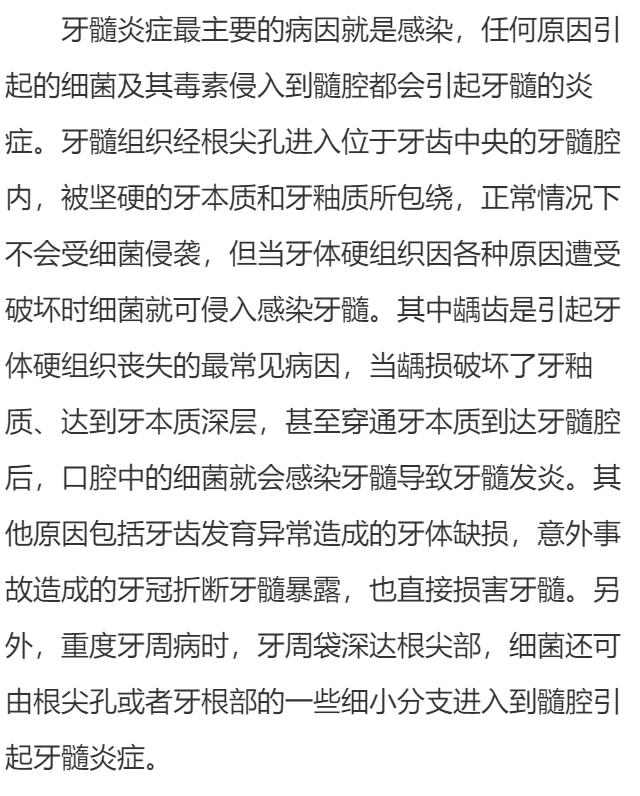 牙髓炎是由什么原因引起的?
