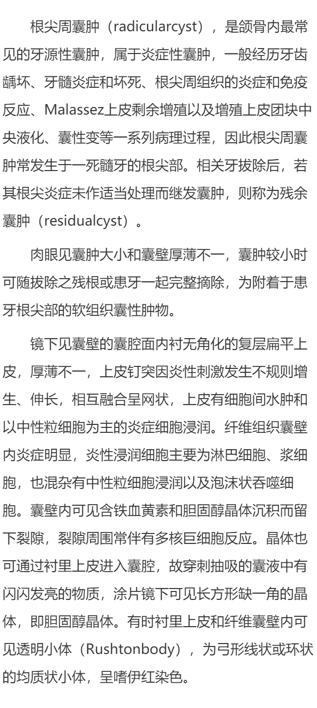根尖周囊肿的病理