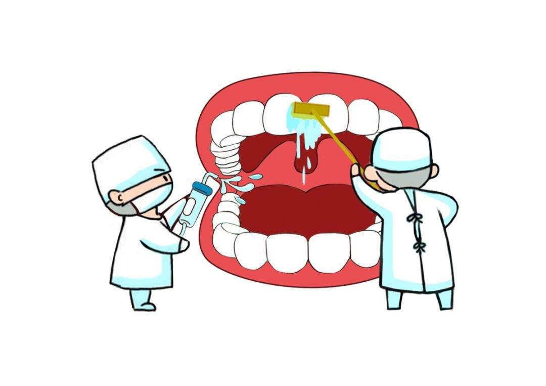 牙周炎洗牙